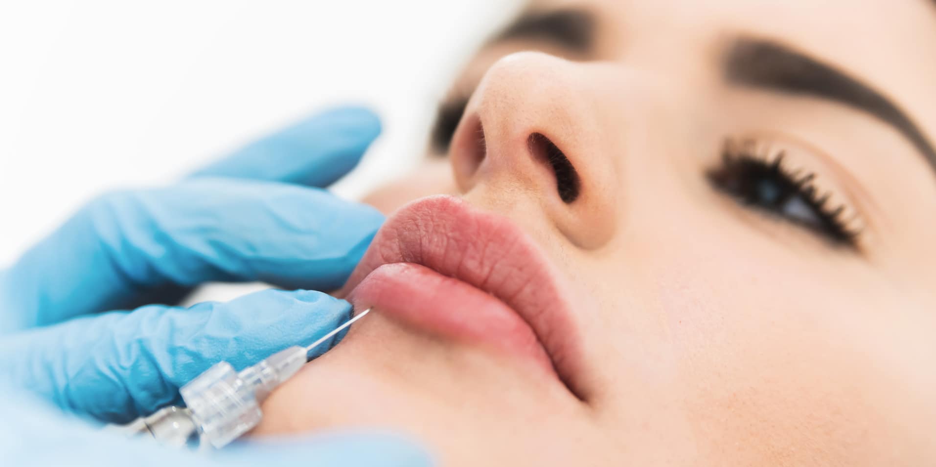 Close-up of lip filler injection being performed by a clinician wearing blue gloves.